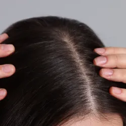 <b>Clear dandruff, flakes, or scalp buildup</b>